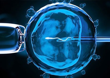 一代、二代、三代试管有什么区别？分别适合什么人群？（2026科普）